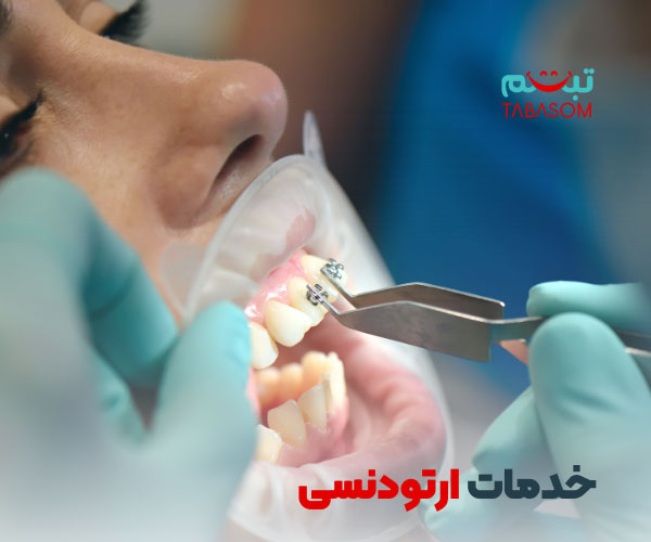 خدمات ارتودنسی قم توسط بهترین پزشکان متخصص در کلینیک تبسم